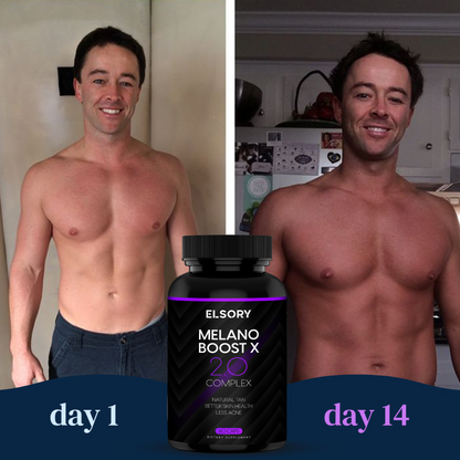 MelanoBoost X – tanning support