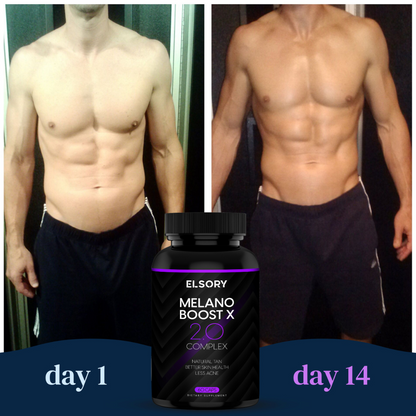 MelanoBoost X – tanning support